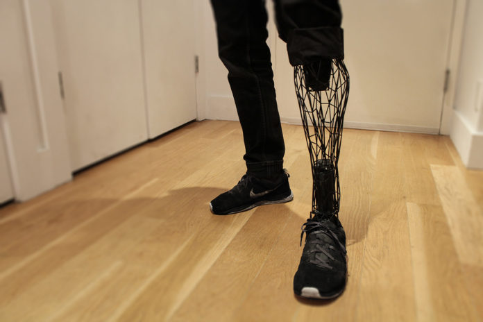 exo-3-printed-leg-prosthesis-in-action-696x464
